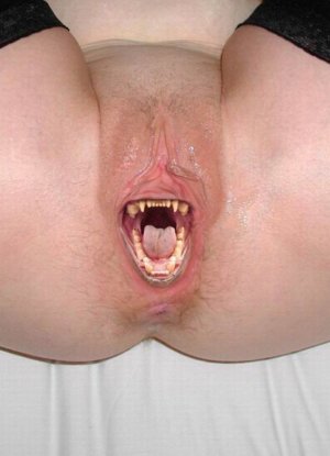 Инфантильная вульва картинка 26